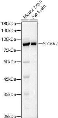 Western Blot: SLC6A2/NET/Noradrenaline transporter Antibody [NBP2-93180] - Analysis of extracts of various cell lines, using SLC6A2 antibody at 1:1015 dilution. Secondary antibody: HRP Goat Anti-Rabbit IgG (H+L) at 1:10000 dilution.Lysates/proteins: 25ug per lane. Blocking buffer: 3% nonfat dry milk in TBST.Detection: ECL Basic Kit. Exposure time: 1s.