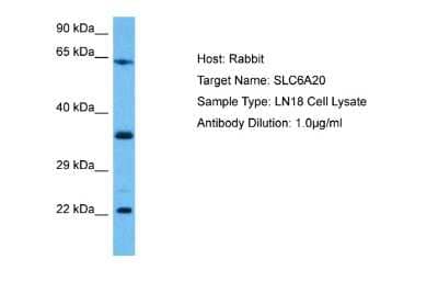 Western Blot: SLC6A20 Antibody [NBP2-84268] - Host: Rabbit. Target Name: SLC6A20. Sample Tissue: Human LN18 Whole Cell lysates. Antibody Dilution: 1ug/ml