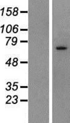 Western Blot: SLC6A20 Overexpression Lysate (Adult Normal) [NBP2-06677] Left-Empty vector transfected control cell lysate (HEK293 cell lysate); Right -Over-expression Lysate for SLC6A20.