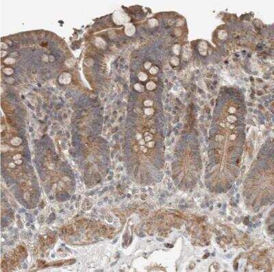 Immunohistochemistry-Paraffin SLC6A7 Antibody