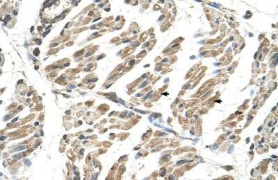 Immunohistochemistry: SLC6A8 Antibody [NBP1-60082] - Paraffin Embedded Tissue: Human Muscle Cellular Data: Skeletal muscle cells Antibody Concentration: 4.0 - 8.0 ug/ml Magnification: 400X