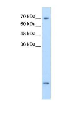 Western Blot: SLC6A8 Antibody [NBP1-60082] - MDA-MB-435S cell lysate, Antibody Titration: 2.5ug/ml