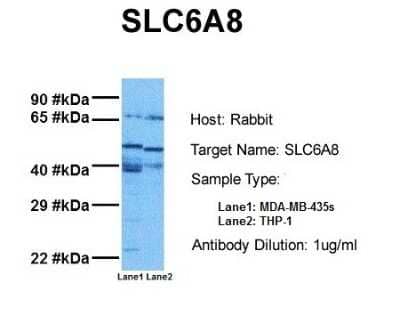 Western Blot: SLC6A8 Antibody [NBP1-60082] - Sample Tissue: Human MDA-MB-435s, Human THP - 1 Antibody Dilution: 1.0 ug/ml