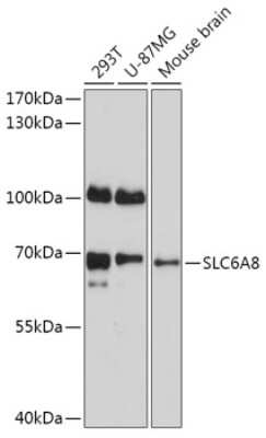 Western Blot: SLC6A8 Antibody [NBP2-94178] - Analysis of extracts of various cell lines, using SLC6A8 at 1:1000 dilution. Secondary antibody: HRP Goat Anti-Rabbit IgG (H+L) at 1:10000 dilution. Lysates/proteins: 25ug per lane. Blocking buffer: 3% nonfat dry milk in TBST. Detection: ECL Basic Kit . Exposure time: 30s.