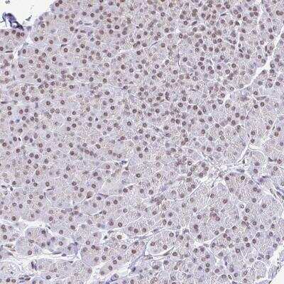Immunohistochemistry-Paraffin: SLC7A10 Antibody [NBP2-38816] - Staining of human pancreas shows moderate nuclear positivity in exocrine glandular cells.