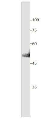 Western Blot SLC7A10 Antibody