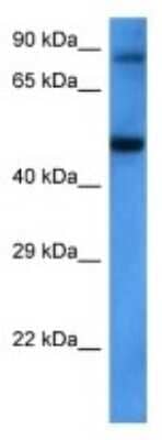 Western Blot: SLC7A13 Antibody [NBP3-11009] - Western blot analysis of SLC7A13 in Jurkat Whole Cell lysates. Antibody dilution at 1ug/ml
