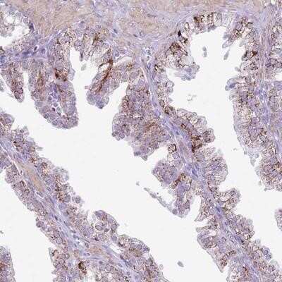 Immunohistochemistry-Paraffin SLC7A14 Antibody