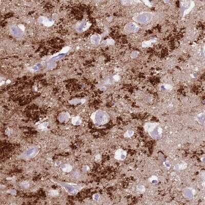 Immunohistochemistry-Paraffin SLC7A14 Antibody