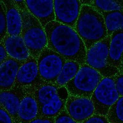 Immunocytochemistry/Immunofluorescence: SLC7A2 Antibody [NBP2-58924] - Staining of human cell line MCF7 shows localization to plasma membrane. Antibody staining is shown in green.