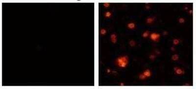 Immunocytochemistry/Immunofluorescence: SLC7A3 Antibody [NBP1-78911] - Immunocytochemical detection of SLC7A3 in 293T transiently expressing SLC7A3 with NBP1-78911 (right) or normal rabbit IgG (left).