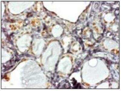Immunohistochemistry-Paraffin: SLC7A3 Antibody [NBP1-78911] - Immunohistochemical detection of SLC7A3 on paraffin embedded section of human thyroid with SLC7A3 Antibody.