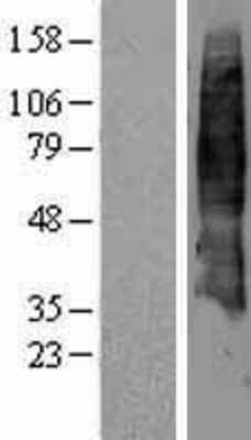 Western Blot: SLC7A4 Overexpression Lysate (Adult Normal) [NBL1-16187] Left-Empty vector transfected control cell lysate (HEK293 cell lysate); Right -Over-expression Lysate for SLC7A4.