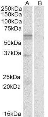 Western Blot: SLC7A5 Antibody [NBP1-51935] (0.3ug/ml) staining of Human Spleen lysate (35ug protein in RIPA buffer) with (B) and without (A) blocking with the immunising peptide. Primary incubation was 1 hour. Detected by chemiluminescence.