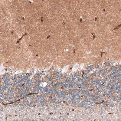 Immunohistochemistry-Paraffin: SLC7A5/LAT1 Antibody [NBP2-33662] - Staining of human cerebellum shows strong membranous positivity in endothelial cells, as well as moderate immunoreactivity in neuropil.