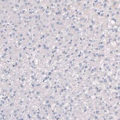 Immunohistochemistry-Paraffin: SLC7A5/LAT1 Antibody [NBP2-33662] - Staining of human liver shows no positivity in hepatocytes as expected.