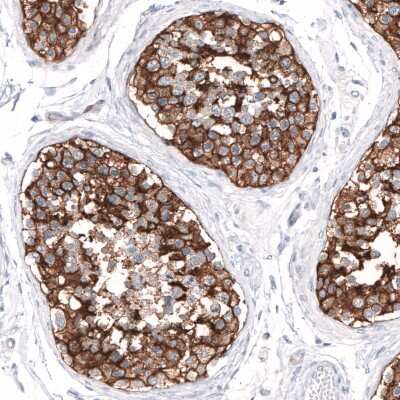 Immunohistochemistry-Paraffin SLC7A5/LAT1 Antibody