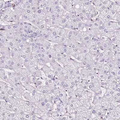 Immunohistochemistry-Paraffin: SLC7A8 Antibody [NBP2-49026] - Staining of human liver shows low expression as expected.