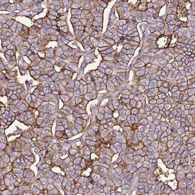 Immunohistochemistry-Paraffin: SLC7A8 Antibody [NBP2-49026] - Staining of human parathyroid gland shows high expression.