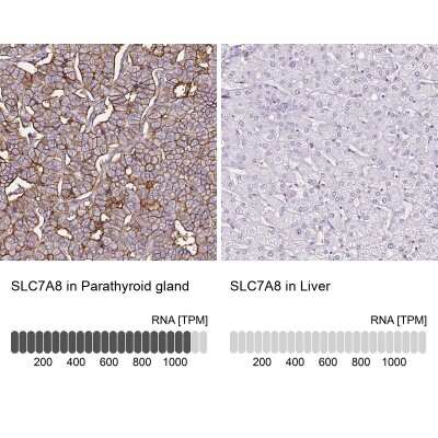 <b>Orthogonal Strategies Validation. </b>Immunohistochemistry-Paraffin: SLC7A8 Antibody [NBP2-49026] - Staining in human parathyroid gland and liver tissues using anti-SLC7A8 antibody. Corresponding SLC7A8 RNA-seq data are presented for the same tissues.