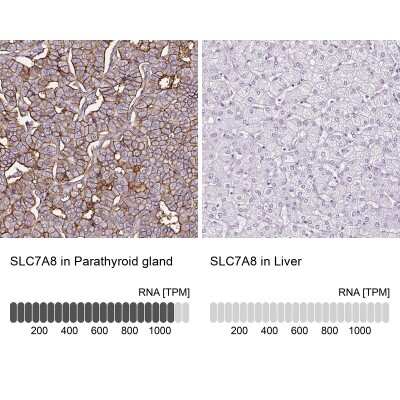 <b>Orthogonal Strategies Validation. </b>Immunohistochemistry-Paraffin: SLC7A8 Antibody [NBP2-49026] - Analysis in human parathyroid gland and liver tissues. Corresponding SLC7A8 RNA-seq data are presented for the same tissues.