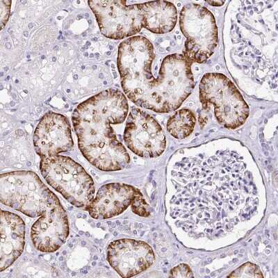 Immunohistochemistry-Paraffin: SLC7A8 Antibody [NBP2-49026] - Staining of human kidney shows moderate to strong cytoplasmic positivity in cells in tubules.