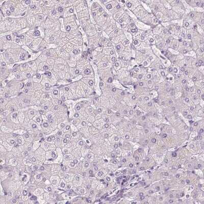 Immunohistochemistry-Paraffin: SLC7A8 Antibody [NBP2-49319] - Staining of human liver shows low expression as expected.