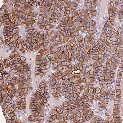 Immunohistochemistry-Paraffin: SLC7A8 Antibody [NBP2-49319] - Staining of human parathyroid gland shows high expression.