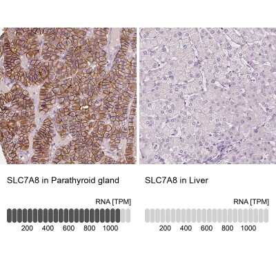 <b>Orthogonal Strategies Validation. </b>Immunohistochemistry-Paraffin: SLC7A8 Antibody [NBP2-49319] - Staining in human parathyroid gland and liver tissues using anti-SLC7A8 antibody. Corresponding SLC7A8 RNA-seq data are presented for the same tissues.