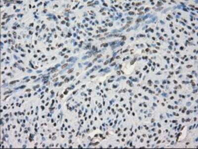 Immunohistochemistry: SLC7A8 Antibody (OTI7D6) - Azide and BSA Free [NBP2-74215] - Staining of paraffin-embedded endometrium tissue using anti-SLC7A8 mouse monoclonal antibody.