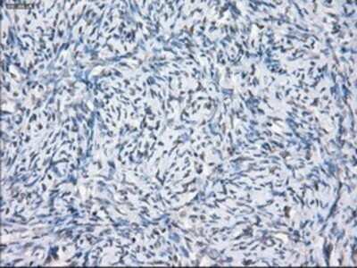 Immunohistochemistry: SLC7A8 Antibody (OTI7D6) - Azide and BSA Free [NBP2-74215] - Staining of paraffin-embedded Ovary tissue using anti-SLC7A8mouse monoclonal antibody.