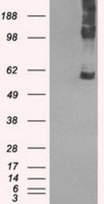 Western Blot: SLC7A8 Antibody (OTI7D6) - Azide and BSA Free [NBP2-74215] - HEK293T cells were transfected with the pCMV6-ENTRY control (Left lane) or pCMV6-ENTRY SLC7A8 (Right lane) cDNA for 48 hrs and lysed. Equivalent amounts of cell lysates (5 ug per lane) were separated by SDS-PAGE and immunoblotted with anti-SLC7A8.