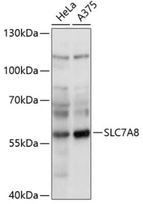 Western Blot: SLC7A8 Antibody [NBP2-93913] - Analysis of extracts of various cell lines, using SLC7A8 at 1:1000 dilution. Secondary antibody: HRP Goat Anti-Rabbit IgG (H+L) at 1:10000 dilution. Lysates/proteins: 25ug per lane. Blocking buffer: 3% nonfat dry milk in TBST. Detection: ECL Basic Kit . Exposure time: 10s.