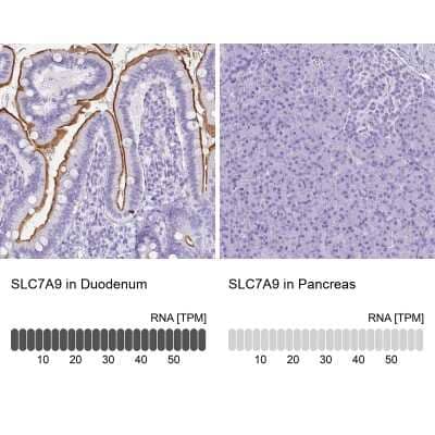 Immunohistochemistry-Paraffin: SLC7A9 Antibody [NBP1-92409] - Analysis in human duodenum and pancreas tissues using NBP1-92409 antibody. Corresponding SLC7A9 RNA-seq data are presented for the same tissues.