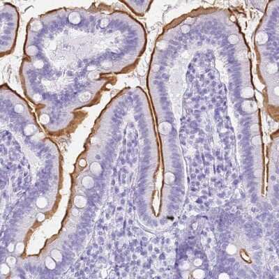 Immunohistochemistry-Paraffin: SLC7A9 Antibody [NBP1-92409] - Staining of human duodenum shows strong positivity in apical membrane in glandular cells.