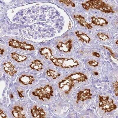 Immunohistochemistry-Paraffin: SLC7A9 Antibody [NBP1-92409] - Staining of human kidney shows strong positivity in apical membrane in cells in proximal tubules.