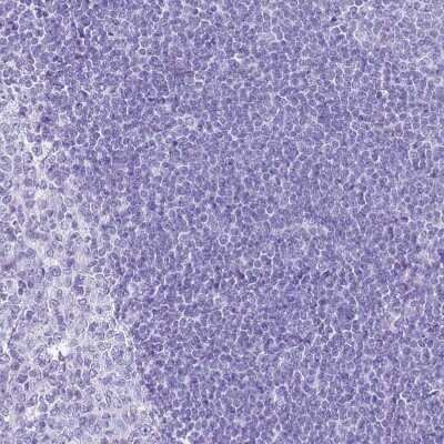 <b>Orthogonal Strategies Validation. </b>Immunohistochemistry-Paraffin: SLC7A9 Antibody [NBP1-92409] - Staining of human tonsil shows no positivity in non-germinal center cells as expected.