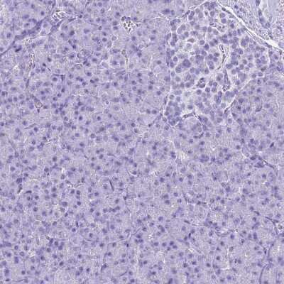 Immunohistochemistry-Paraffin: SLC7A9 Antibody [NBP1-92409] - Staining of human pancreas shows no positivity in exocrine glandular cells as expected.