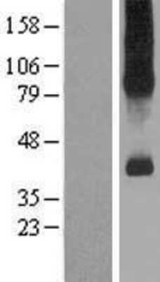 Western Blot: SLC7A9 Overexpression Lysate (Adult Normal) [NBP2-07364] Left-Empty vector transfected control cell lysate (HEK293 cell lysate); Right -Over-expression Lysate for SLC7A9.