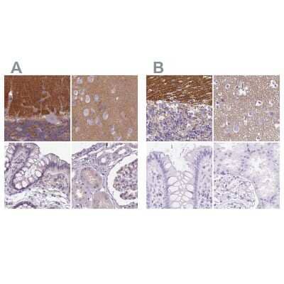 Immunohistochemistry-Paraffin: SLC8A2 Antibody [NBP2-48980] - Staining of human cerebellum, cerebral cortex, colon and kidney using Anti-SLC8A2 antibody NBP2-48980 (A) shows similar protein distribution across tissues to independent antibody NBP2-49145 (B).