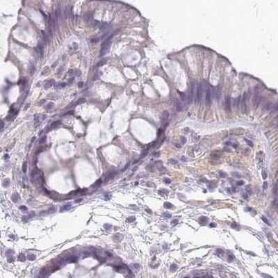 Immunohistochemistry-Paraffin: SLC8A2 Antibody [NBP2-48980] - Staining of human colon.