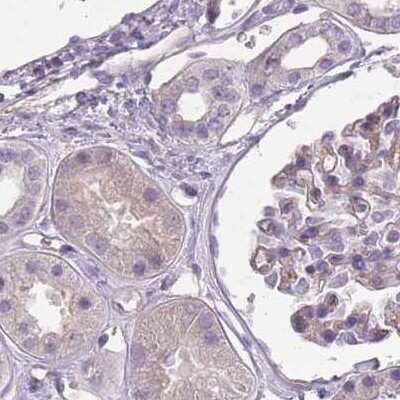 Immunohistochemistry-Paraffin: SLC8A2 Antibody [NBP2-48980] - Staining of human kidney.