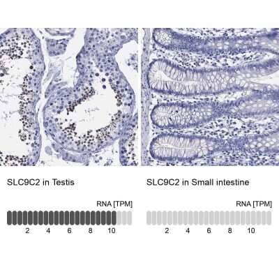 Immunocytochemistry/ Immunofluorescence SLC9A11 Antibody