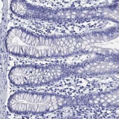 Immunohistochemistry-Paraffin SLC9A11 Antibody