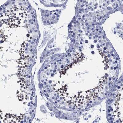 Immunohistochemistry-Paraffin SLC9A11 Antibody