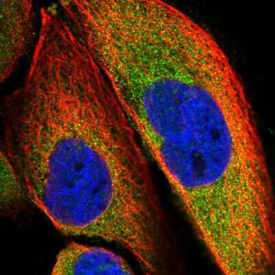 Immunocytochemistry/ Immunofluorescence SLC9A5 Antibody