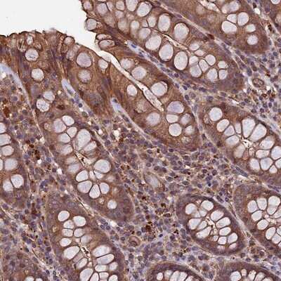 Immunohistochemistry-Paraffin SLC9A5 Antibody