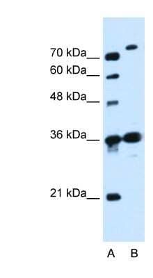 Western Blot: SLC9A7 Antibody [NBP1-62455] - Titration: 0.2-1 ug/ml, Positive Control: Jurkat cell lysate.