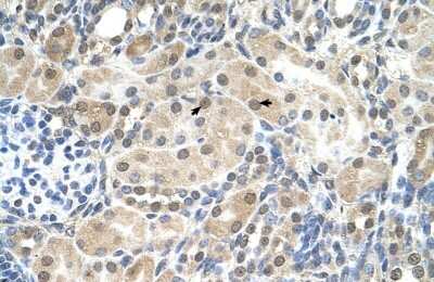 Immunohistochemistry-Paraffin SLC9A9 Antibody