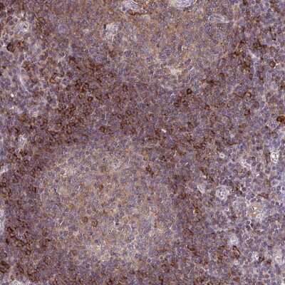 Immunohistochemistry-Paraffin SLC9A9 Antibody